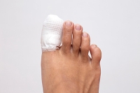 Possible Causes of Broken Toes