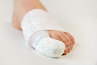 Does My Broken Toe Require Surgery?