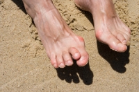 What Causes Hammertoes?