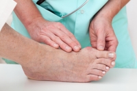 Is Surgery Right for My Bunion?